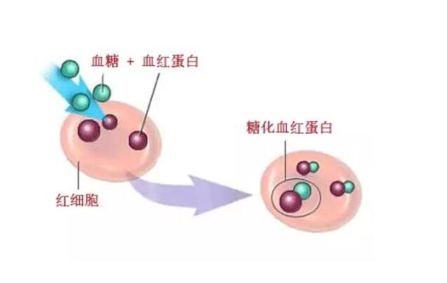 糖化血红蛋白高是什么意思？为何血糖控制水平要看它？医生一次说明白